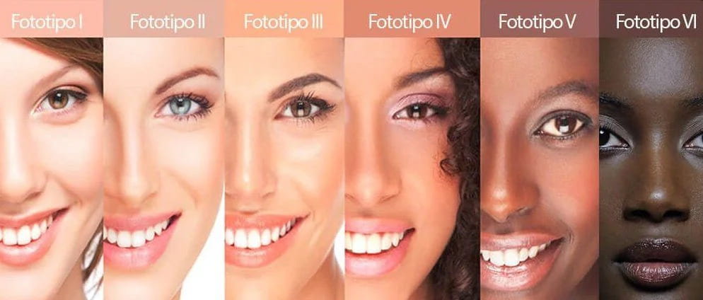 Fototipos de pieles I-VI